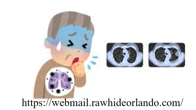 Mengungkap Penyebab Radang Paru-Paru: Faktor Risiko